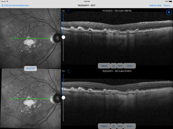 SonomedEscalon Axis iPad screenshot 4 - Medical app