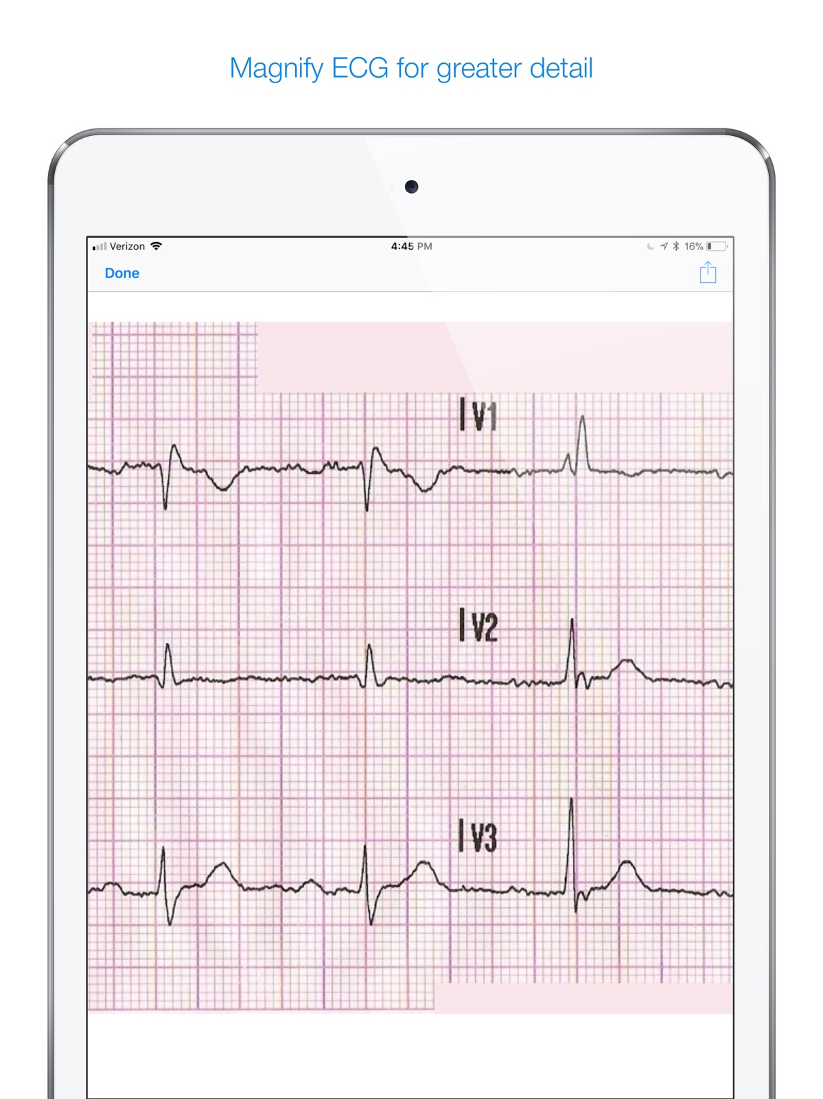 12 Lead ECG Challenge ipad screenshot 1