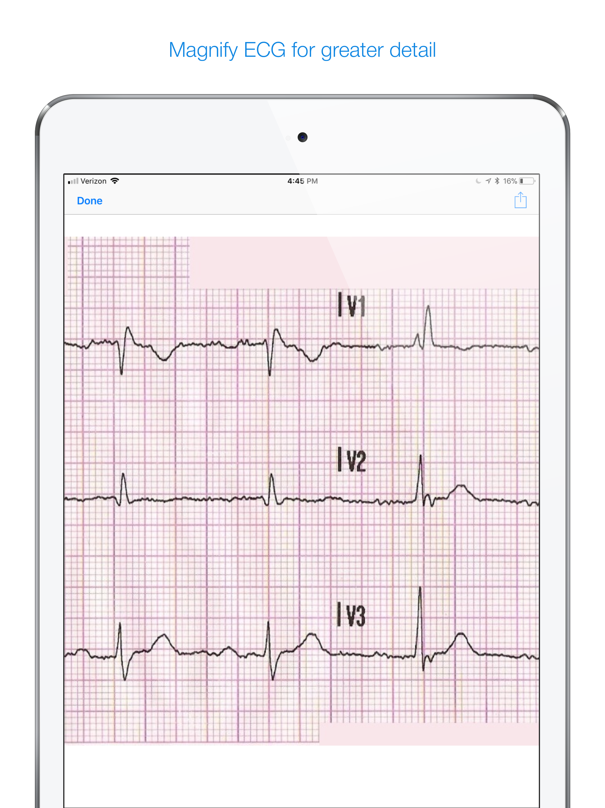 12 Lead ECG Challenge screenshot 12