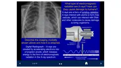 Basic Radiology - SecondLook iPhone image 2