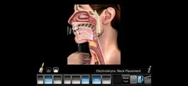 Game screenshot Laryngectomy hack