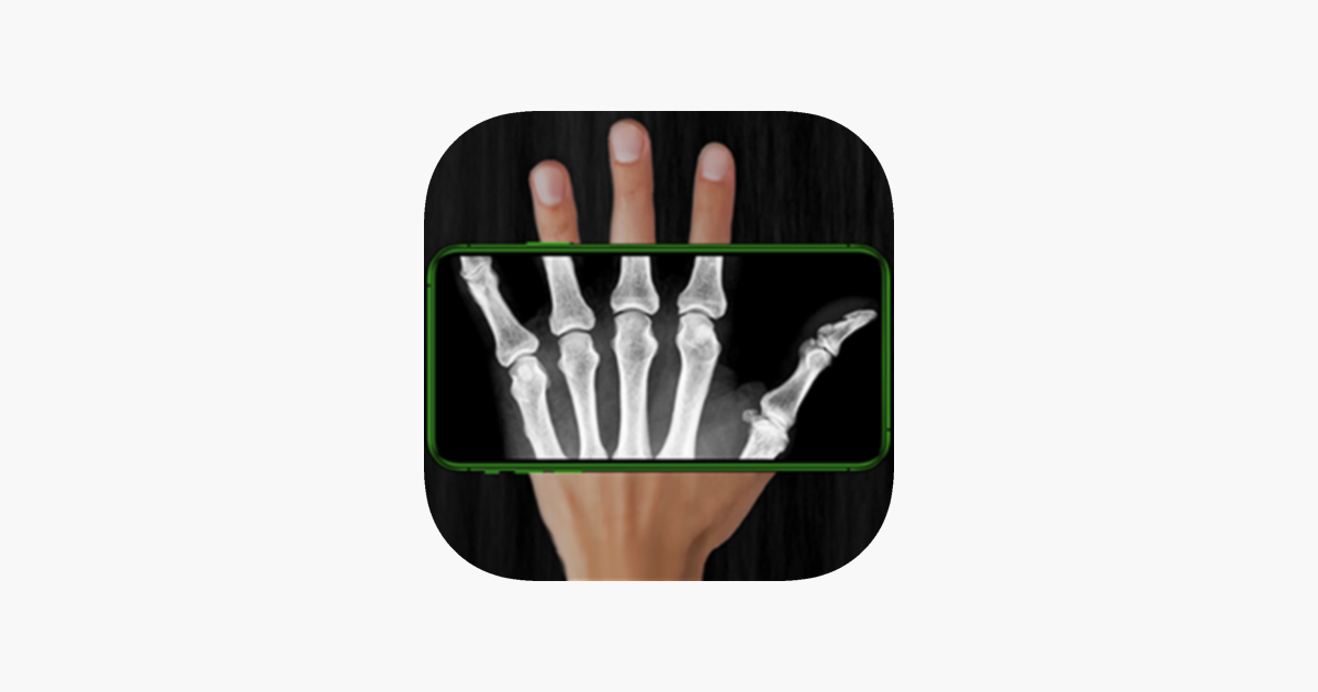 Rayos X Escáner Simulador en App Store
