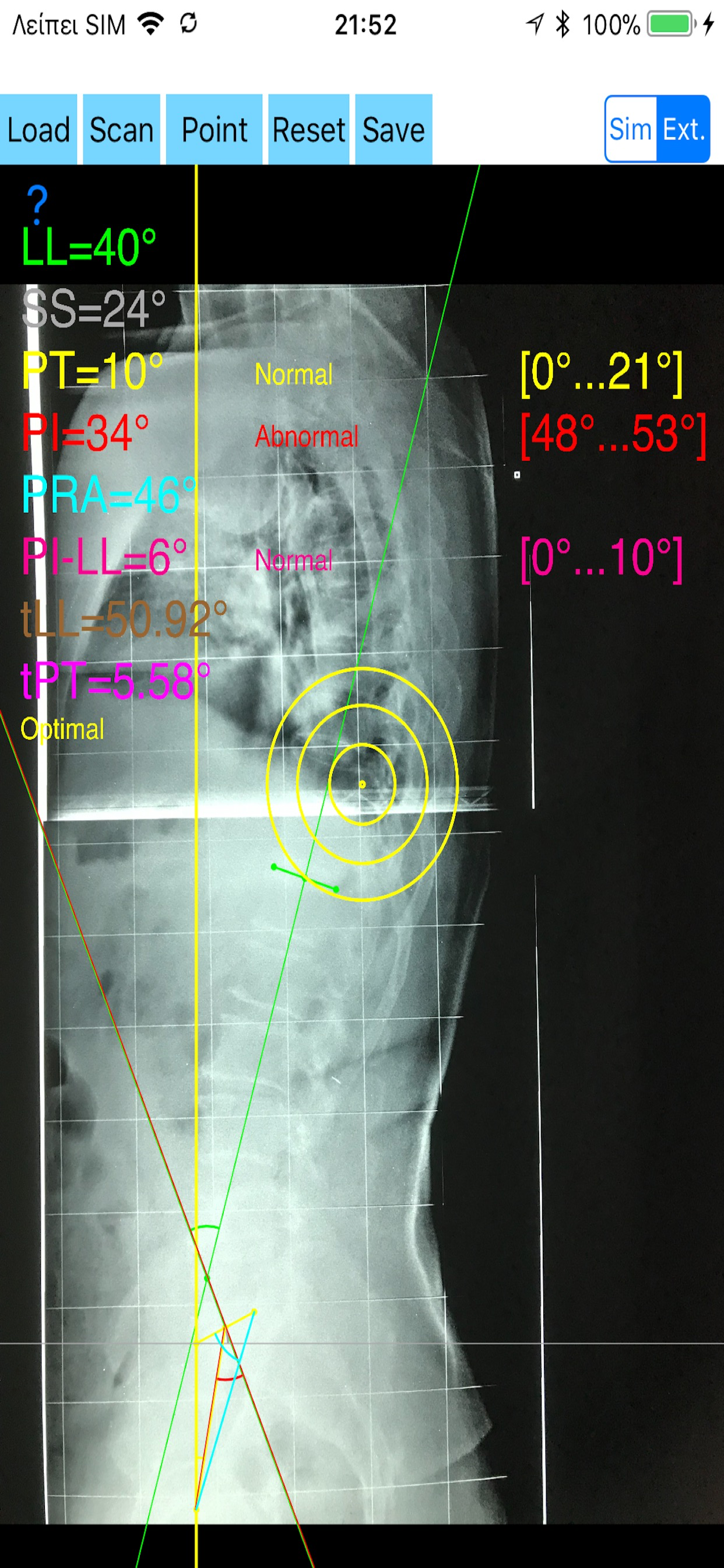 SpinopelvicBalanceApp