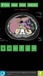 anatomy on radiology ct iphone screenshot 1