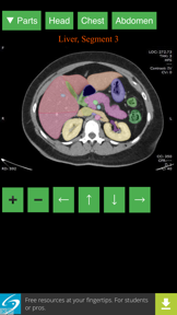 Anatomy on Radiology CT screenshot