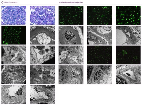 Renal Transplant Pathologyのおすすめ画像2