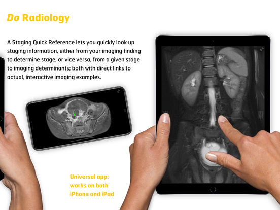 Screenshot #6 pour Gyn Cancer Staging Atlas