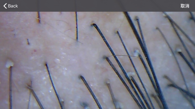 头皮毛发检测-新生活 screenshot-4