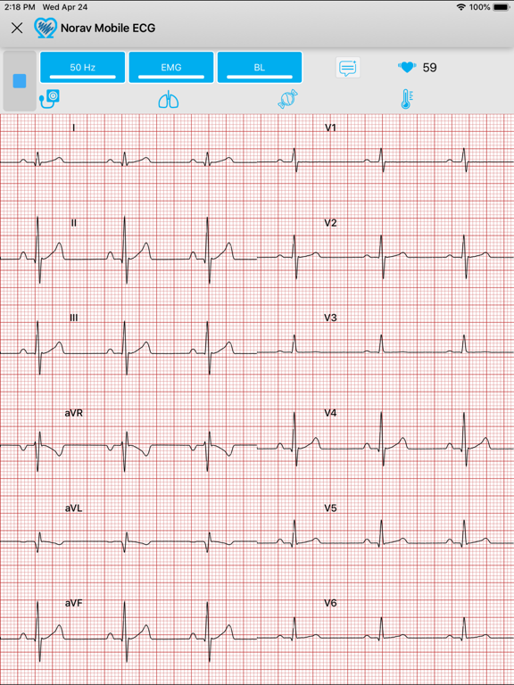 Screenshot #6 pour Norav Medical Mobile ECG