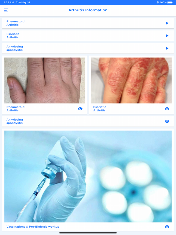 Arthritis+ Patient iPad screenshot 5 - Medical app