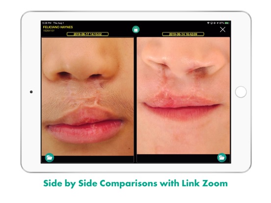 Screenshot #4 pour ZenSnapMD