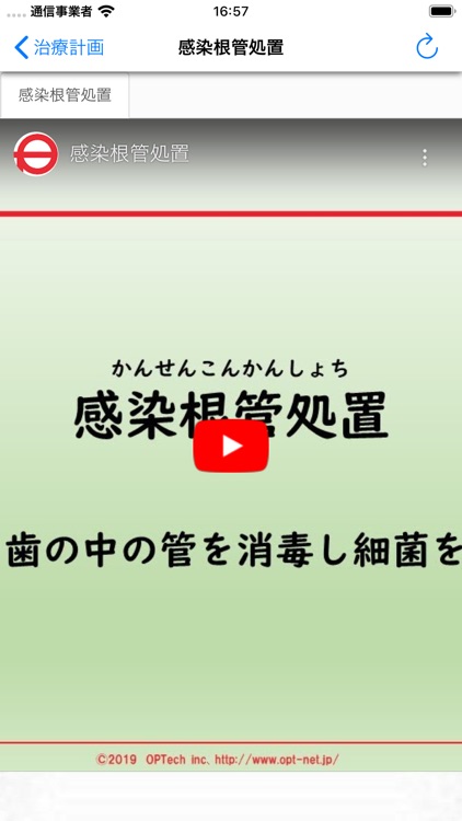 治療計画AI screenshot-4