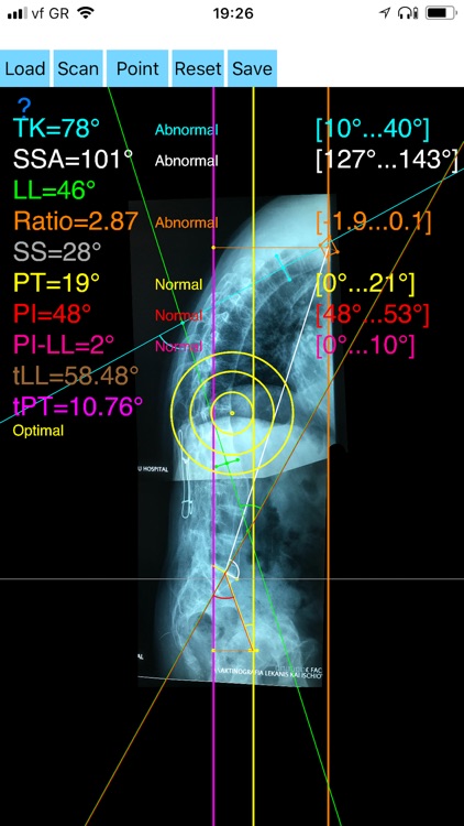 SagittalBalanceApp screenshot-4