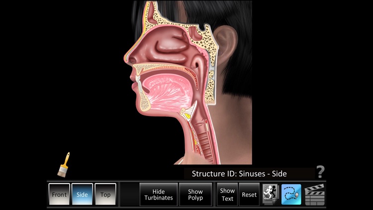 Sinus ID screenshot-3