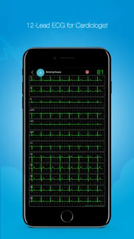 Game screenshot vhECG Pro apk