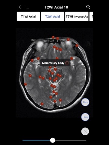 MedImaging-Radiology Made Easyのおすすめ画像3