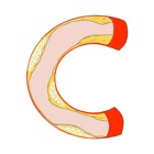 CalcificAID