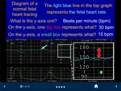 Fetal Heart Rate - SecondLook iPad image 2