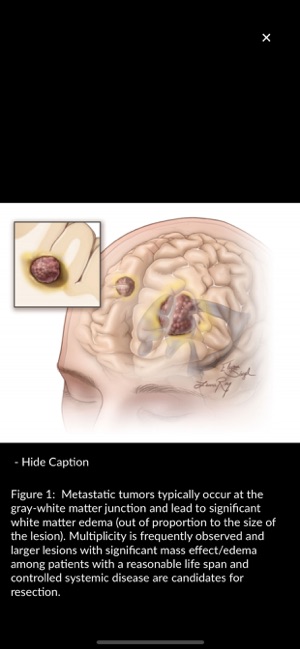 Neurosurgical Atlas(圖4)-速報App
