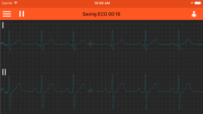Screenshot #1 pour Spaulding ECG