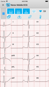 Norav Medical Mobile ECG screenshot