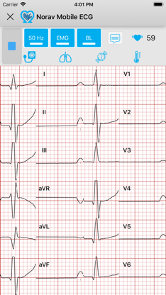 Norav Medical Mobile ECG screenshot 3