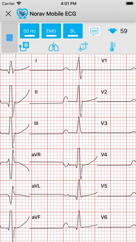 Norav Medical Mobile ECG - Reviews, Revenue and Downloads - Apple App ...