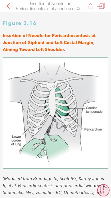 Harriet Lane Handbook App screenshot-4