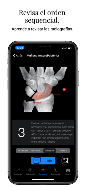 XRay Assistant(圖4)-速報App