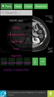 anatomy on radiology ct iphone screenshot 3