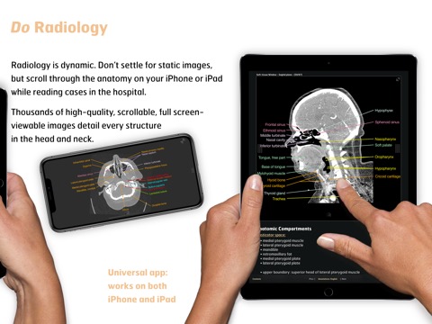 Radiology - Head&Neck Anatomyのおすすめ画像3