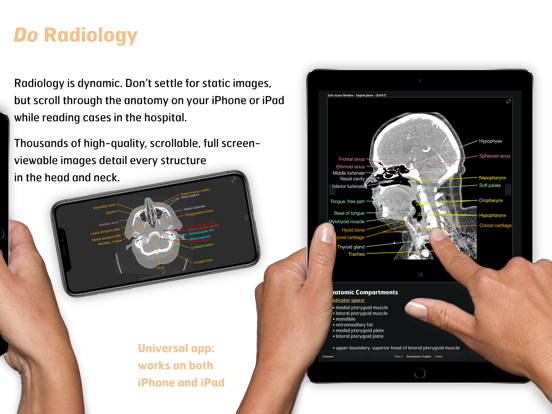 Screenshot #6 pour Radiology - Head&Neck Anatomy