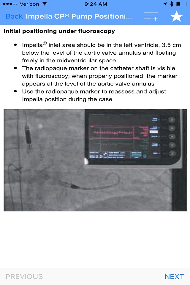 Impella App screenshot 3