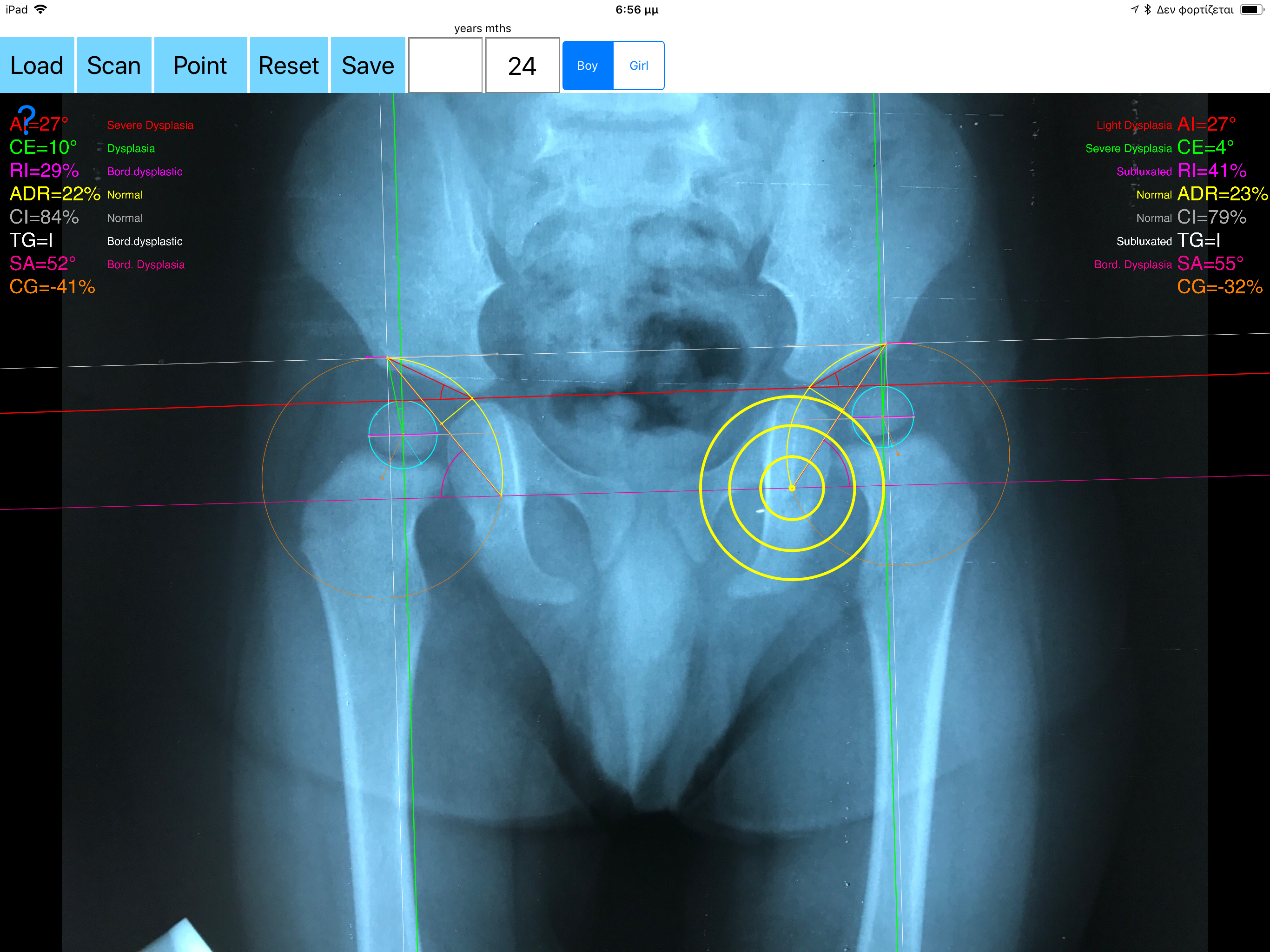 HipDysplasiaApp screenshot 15