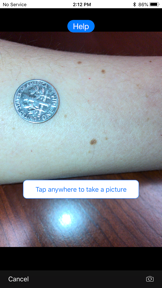Mole Mapper Melanoma Study screenshot