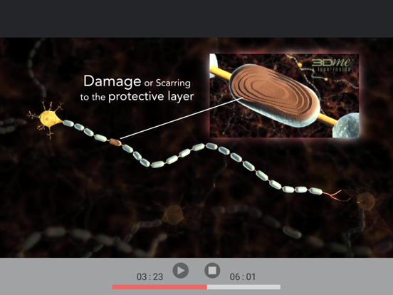 Screenshot #6 pour MS 3Dme