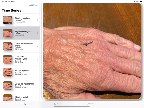 Screenshot #4 pour DermShot