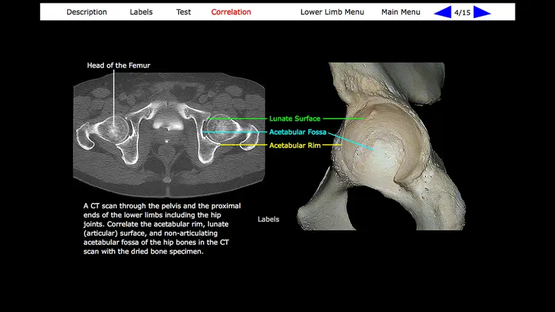 Human Skeleton: Gross Anatomy screenshot 10 of 10