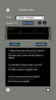 ecg rhythms and acls cases iphone screenshot 3