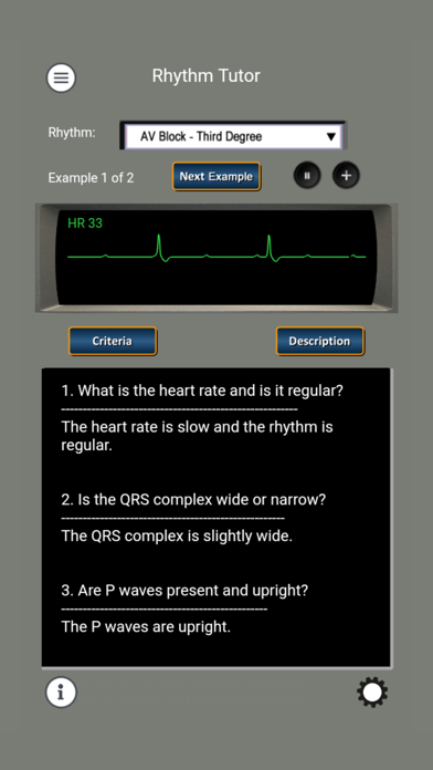 ECG Rhythms and ACLS Cases screenshot 3