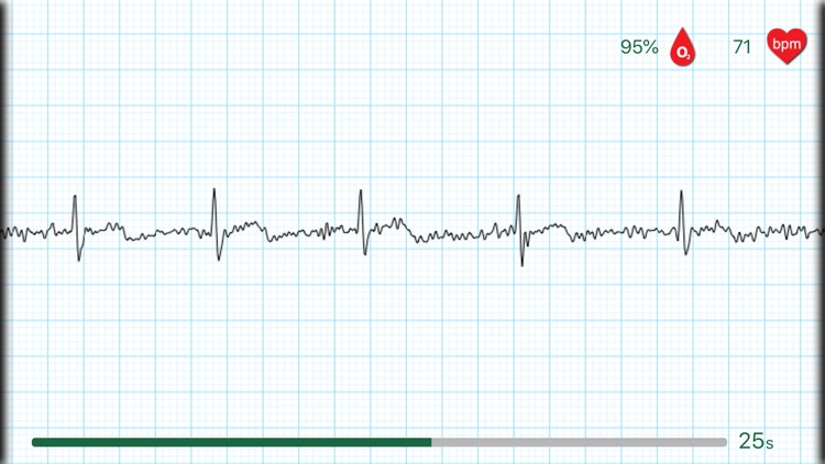 WIWE - ECG diagnostics