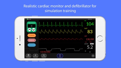 Simpl Patient Monitor Screenshot