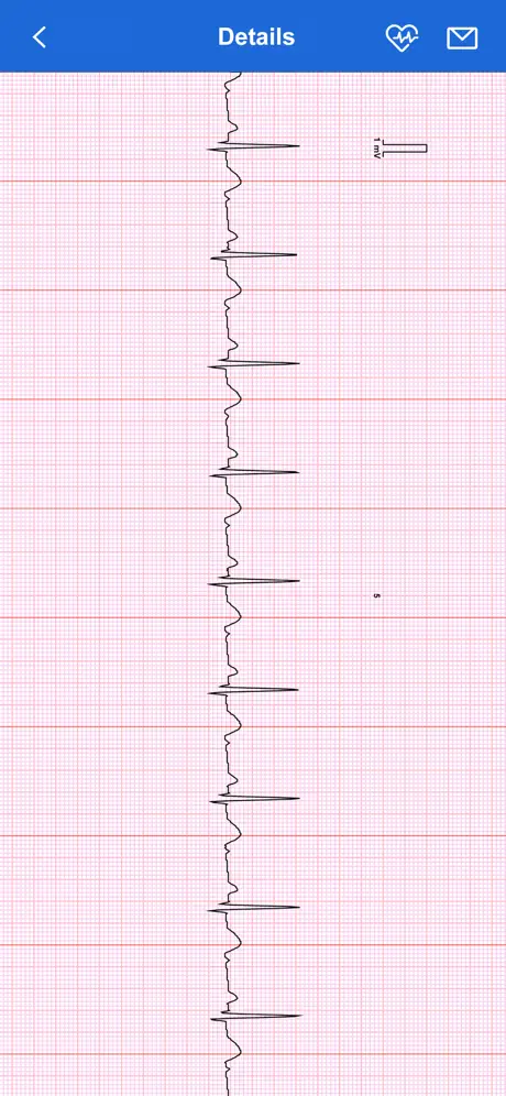 iBP ECG Plus