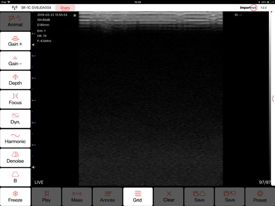 Screenshot #4 pour TecnoScan