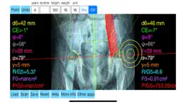 hipbiomechanicsapp problems & solutions and troubleshooting guide - 1