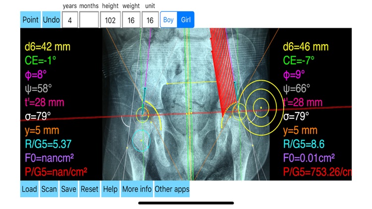 HipBiomechanicsApp screenshot-8