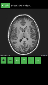 MRI Viewer screenshot