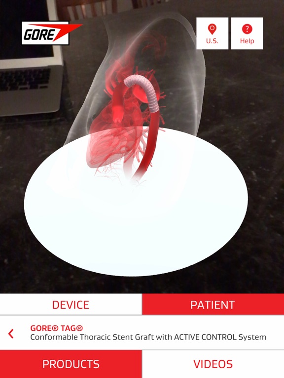 Screenshot #4 pour GoreMED AR