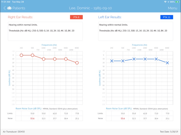 SHOEBOX Audiometry Standard screenshot-8