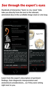 Radiology - Aortic Imaging screenshot